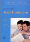 SKAZY KRWOTOCZNE